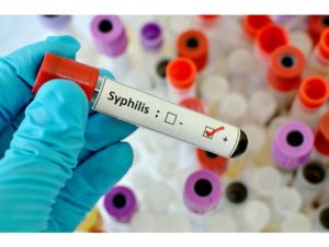 Как сдавать анализ крови на вич гепатит сифилис thumbnail
