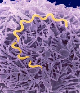 Анализ на спид гепатит и сифилис как выглядит thumbnail