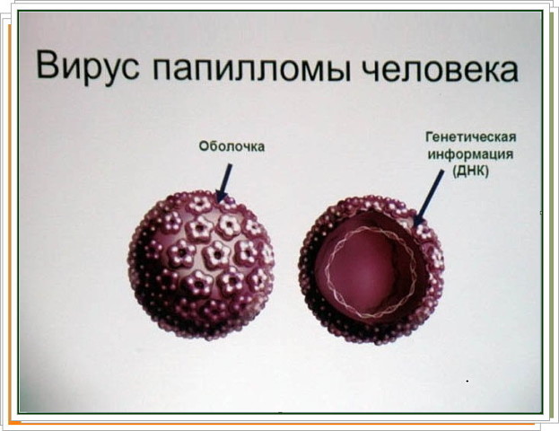 Кондиломы у девушек фото