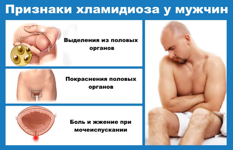 Первые признаки инфекции у мужчин. Урогенитальный хламидиоз у мужчин. Невенеричечкие заболевания. Венерические заболтапни.