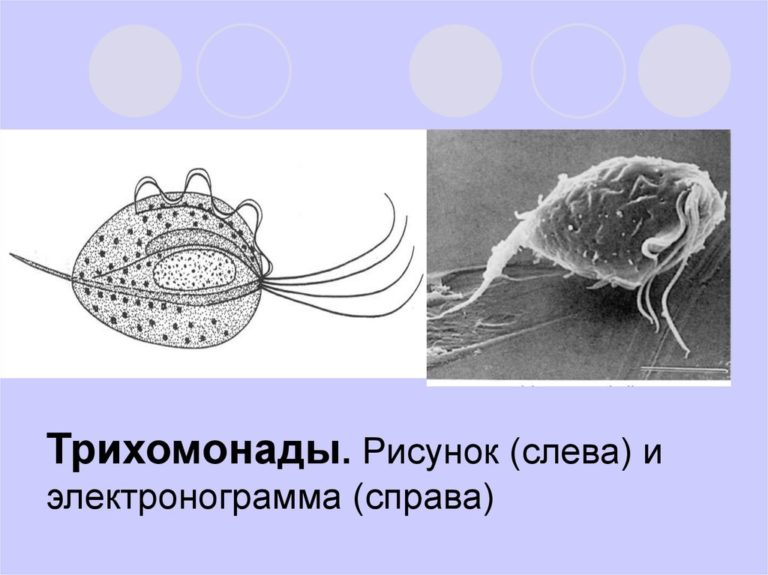 Трихомонада у мужчин фото